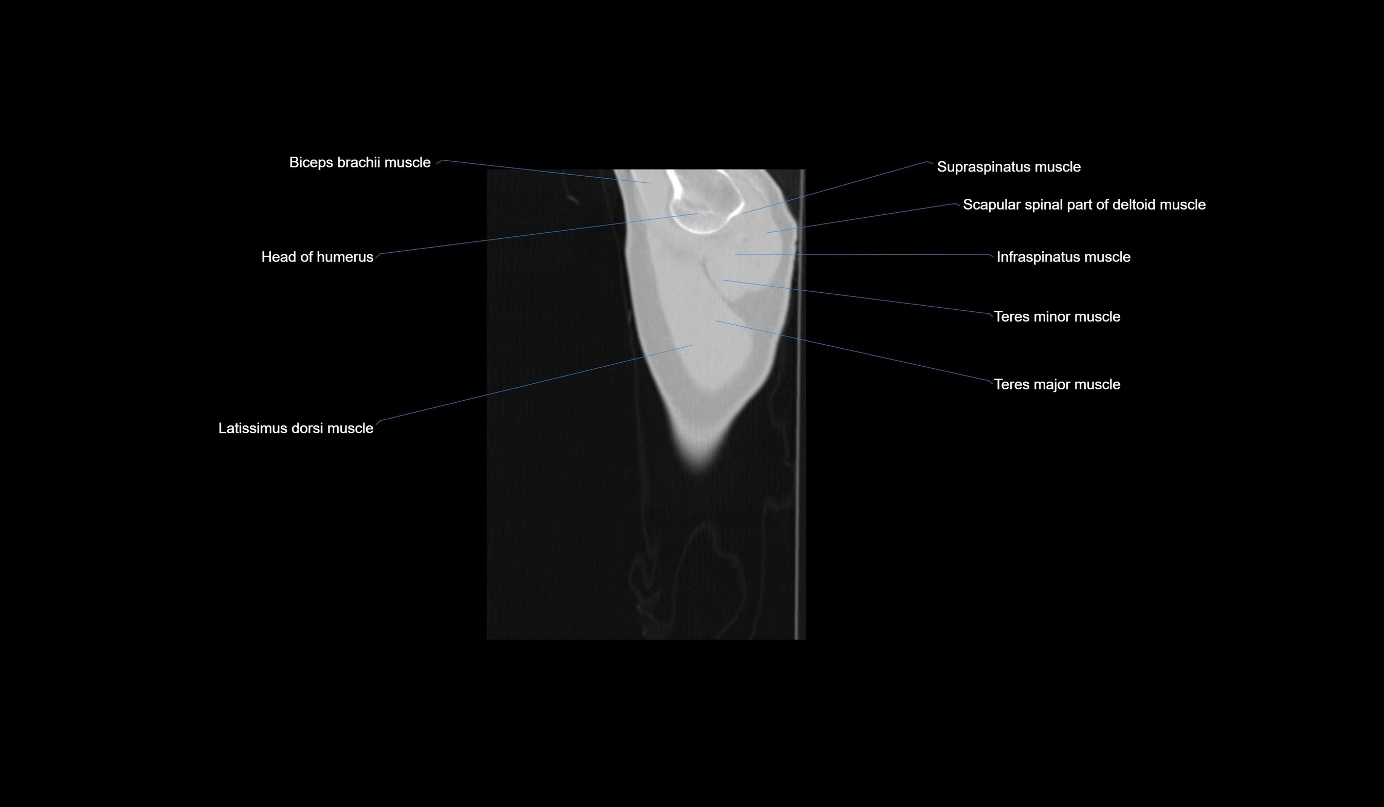 CT chest (thorax) labelled sagittal cross sectional anatomy radiology image-00002.webp